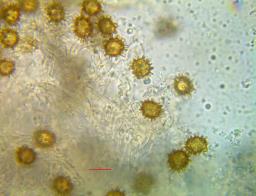 Inocybe calospora