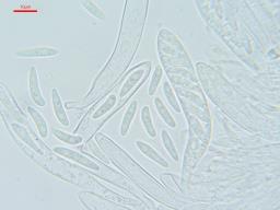 Arachnopeziza leonina