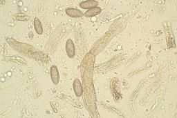 Suillellus luridus