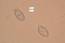 Psilopezia nummularia