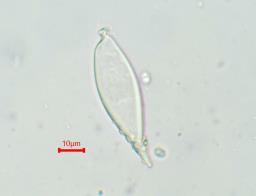 Hohenbuehelia petalodes