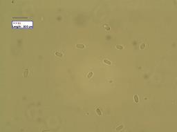 Leptosphaeria acuta