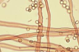 Tulostoma squamosum