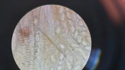 Lasiobolus ciliatus