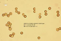 Tulostoma squamosum