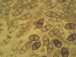 Gymnosporangium sabinae