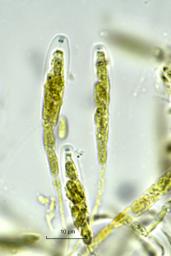 Eutypa spinosa