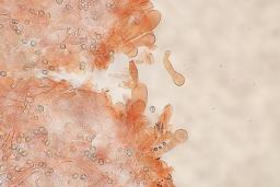 Pluteus petasatus