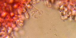 Sistotrema brinkmannii