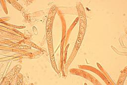 Hymenoscyphus imberbis