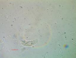 Platygloea disciformis