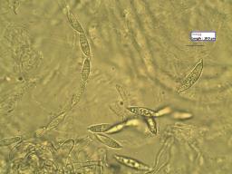 Hypomyces lateritius