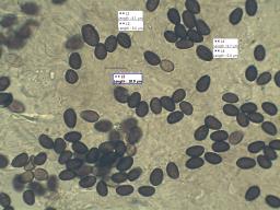 Typhrasa gossypina