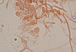 Resupinatus striatulus