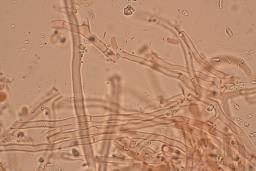 Byssomerulius corium