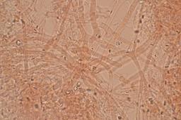 Byssomerulius corium