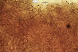Neonectria punicea