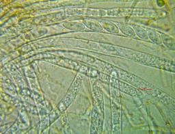 Hymenoscyphus eichleri