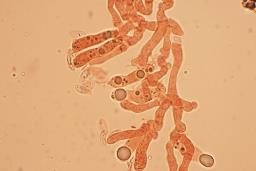 Atractosporocybe inornata