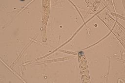 Lanzia luteovirescens