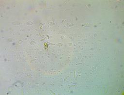 Cytospora leucostoma