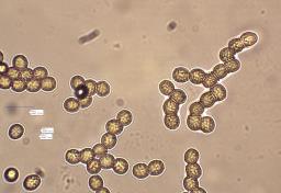 Aspergillus flavus