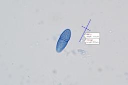 Neonectria punicea