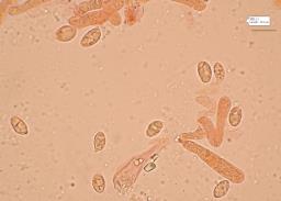 Hygrophorus hyacinthinus