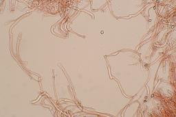 Deconica crobula