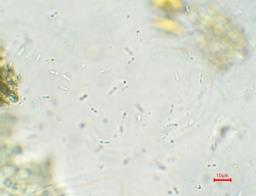 Chlorociboria aeruginascens