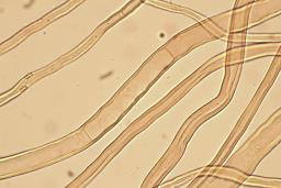 Tulostoma squamosum