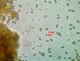Camarops polysperma