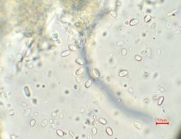 Crucibulum laeve