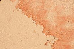 Byssomerulius corium