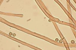 Tulostoma squamosum