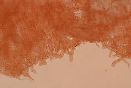 Callistosporium luteo-olivaceum