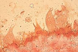 Mycena erubescens