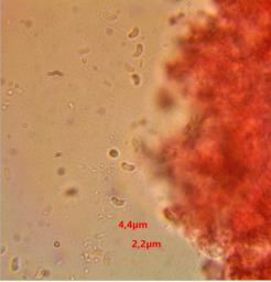 Sistotrema brinkmannii