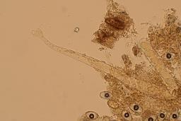 Psilopezia nummularia