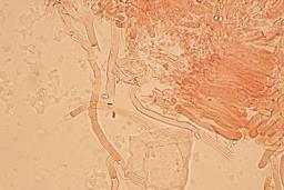 Byssomerulius corium