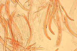 Hymenoscyphus imberbis
