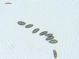 Hypomontagnella submonticulosa