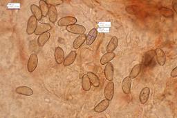 Inosperma cervicolor