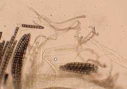 Trichoglossum hirsutum