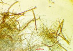 Hymenoscyphus eichleri
