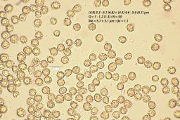 Tulostoma squamosum