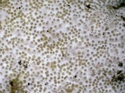 Hypomyces lateritius