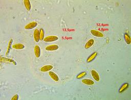 Hymenoscyphus eichleri