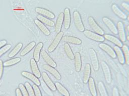 Thyronectria aurigera