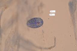 Scutellinia scutellata